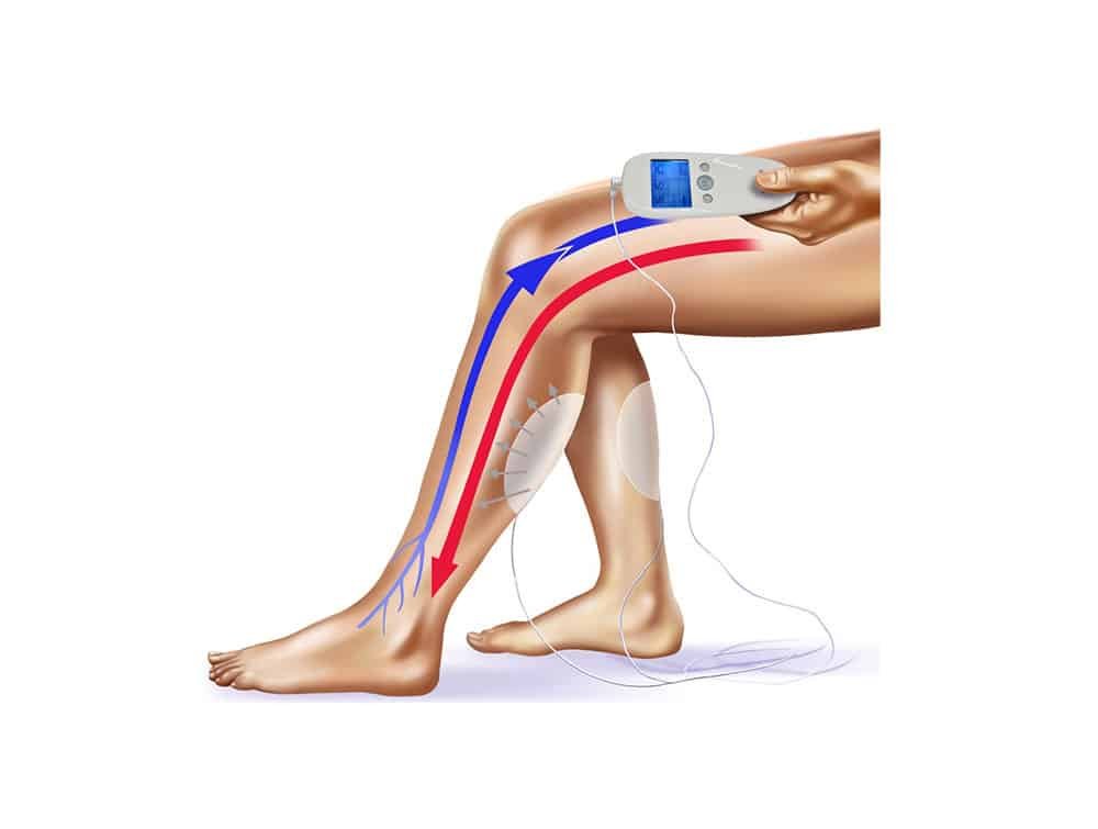 Electrodes VEINOPLUS ( la paire )