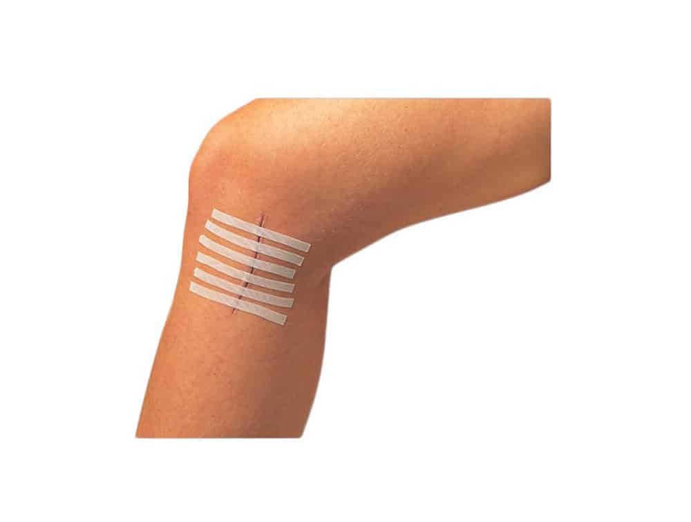Steri-Strip 3M™