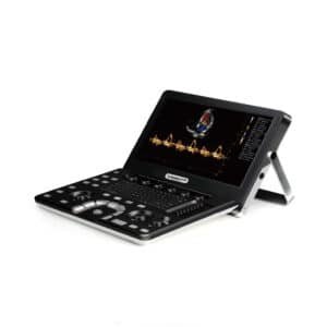 Echographe Vinno A3