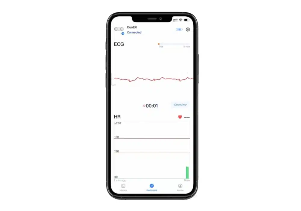 Moniteur ECG portable