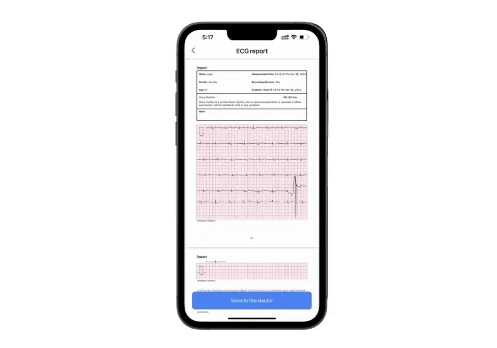 Moniteur ECG portable