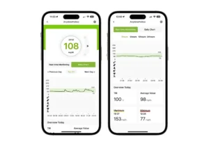 Lecteur-de-glycemie-en-continue-Connecte-CGM-ANYTIME-14